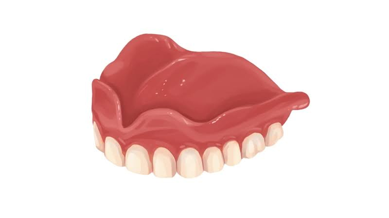 Ποια είναι τα οφέλη της άνω οδοντοστοιχίας χωρίς υπερώα